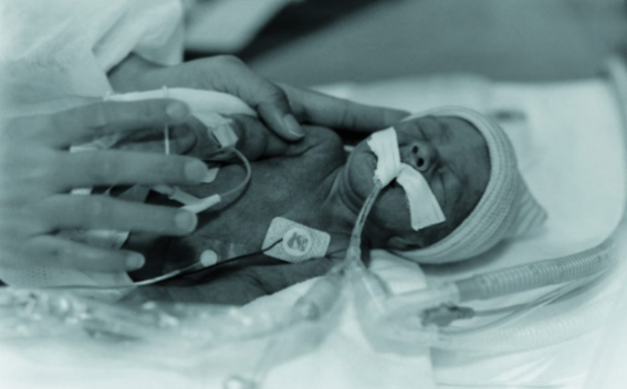 NICU-baby-for-Podcast-resize567x352